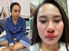 Cô gái bị đánh ghen ở Bà Triệu công khai vết thương, khẳng định oan ức và yêu cầu đưa bằng chứng 'con giáp 13'