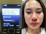 Vụ cô gái bị đánh ghen, lột váy kinh hoàng ở Hà Nội: Nạn nhân làm đơn trình báo công an-3