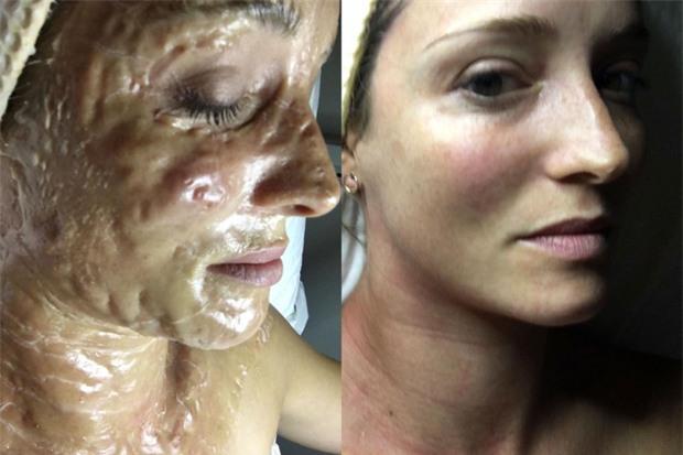 Làm đẹp với ốc sên, đỉa, rắn... trên đời chuyện quái gì cũng có thể xảy ra-4