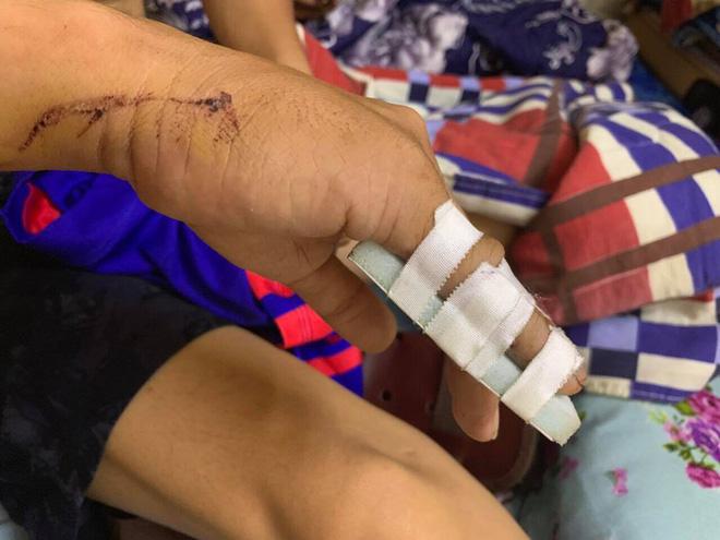 Kinh hoàng 2 thanh niên bị nhóm giang hồ Sài Gòn truy sát từ bãi giữ xe đến Bệnh viện Chợ Rẫy-2