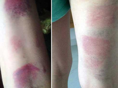 Vụ học sinh lớp 5 mang dao đến trường đâm vào mông bạn: Phê bình nhà trường chậm trễ thông tin-2