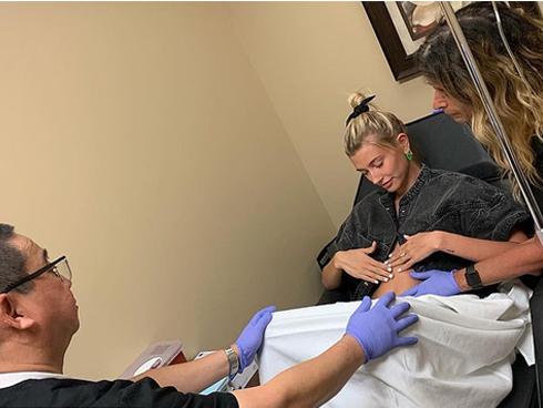 Hailey Baldwin ‘thả rông’ trên bờ biển, khoe vòng một nóng bỏng-7