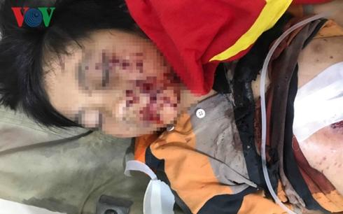 Vừa chơi game vừa sạc pin điện thoại, 1 cháu bé suýt mất mạng-1