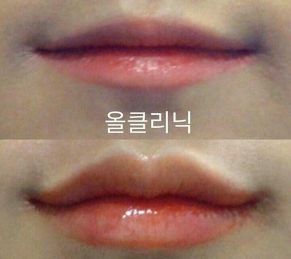 Thiếu nữ Hàn đổ xô đi tạo hình môi chữ M giống chị đẹp Son Ye Jin-4