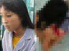 Vụ nữ sinh ở Hưng Yên bị đánh: Sự hối hận muộn màng