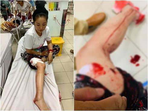 Người mẫu Hạ Vy bàng hoàng khi hai con nhỏ bị ô tô tông chấn thương rồi bỏ chạy-5