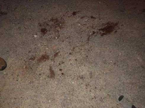 Đàn chó 10 con lao vào cắn bé trai 7 tuổi ở Hưng Yên