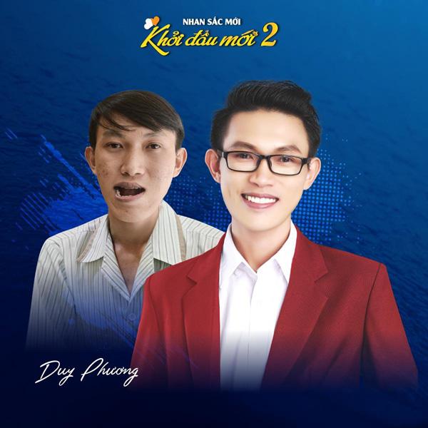 Top 10 nhan sắc lột xác đỉnh cao nhờ phẫu thuật thẩm mỹ-1