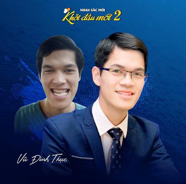 Top 10 nhan sắc lột xác đỉnh cao nhờ phẫu thuật thẩm mỹ-2