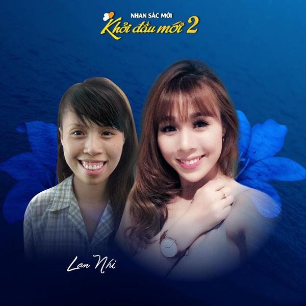 Top 10 nhan sắc lột xác đỉnh cao nhờ phẫu thuật thẩm mỹ-7