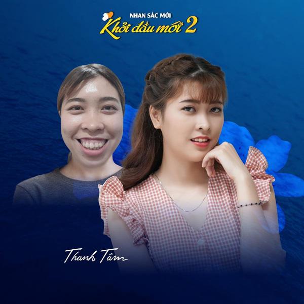 Top 10 nhan sắc lột xác đỉnh cao nhờ phẫu thuật thẩm mỹ-9