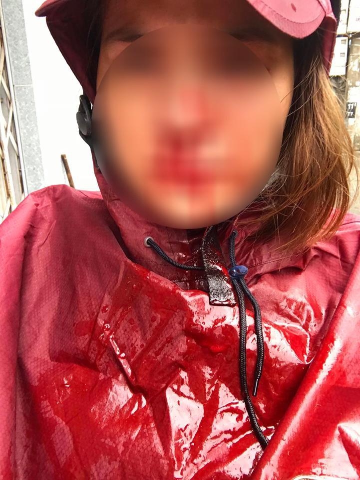 Nhói lòng đọc tâm sự của người vợ hi sinh 12 năm, đến khi có nhà lầu, xe hơi thì chồng đánh đập rồi đi với gái-4