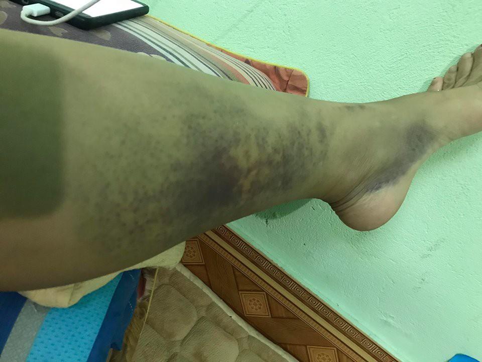 Nhói lòng đọc tâm sự của người vợ hi sinh 12 năm, đến khi có nhà lầu, xe hơi thì chồng đánh đập rồi đi với gái-5