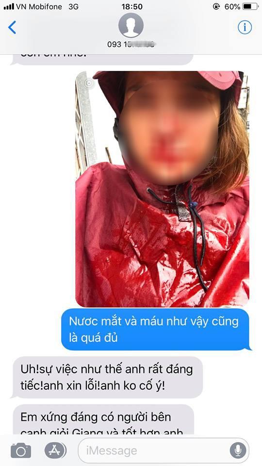 Nhói lòng đọc tâm sự của người vợ hi sinh 12 năm, đến khi có nhà lầu, xe hơi thì chồng đánh đập rồi đi với gái-8