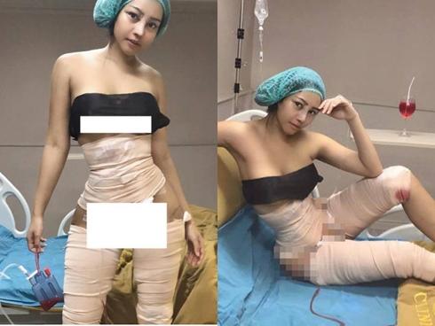 Mạng xã hội Việt dậy sóng với màn lột xác những tưởng chỉ có trên phim của cô gái trẻ sau thẩm mỹ-4