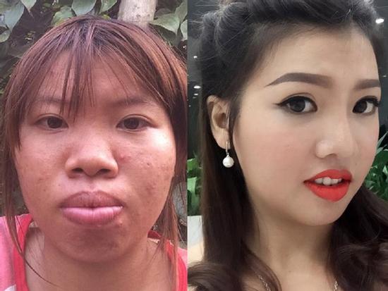 'Thị Nở tái sinh' và 7 ca biến hóa thành hot girl, hot boy gây sốc