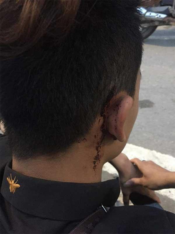 Nữ sinh bị đánh hội đồng ở Quảng Ninh: Nam thanh niên đi cùng cũng bị đánh nhập viện-3
