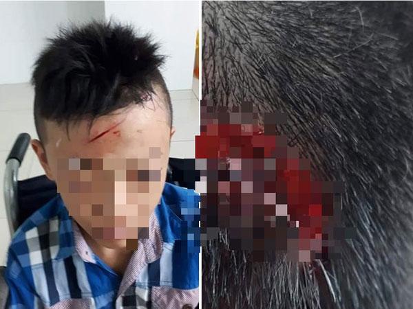 Vĩnh Long: Xác minh thông tin nam sinh lớp 7 bị bạn đánh chảy máu đầu, ngất xỉu 2 lần nhưng nhà trường không đưa đi cấp cứu-1