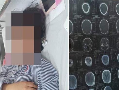 PHẪN NỘ: Học sinh lớp 8 bị bố đánh tím bầm hết người, vừa đến lớp thì ngất xỉu phải đưa đi cấp cứu-5