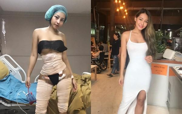 Cô gái chi tiền khủng đại phẫu thuật thẩm mỹ đau đớn để rồi sắc vóc khiến ai cũng kinh ngạc thảng thốt-2