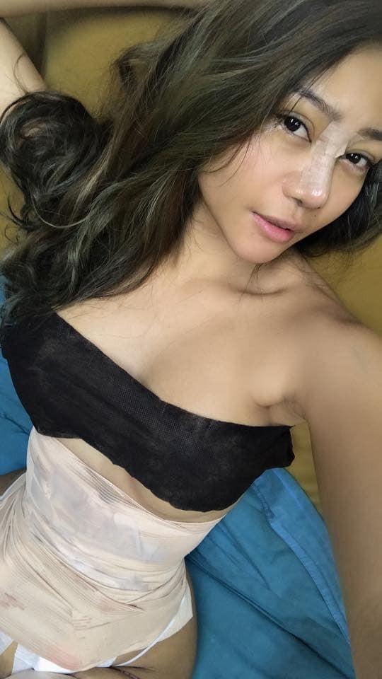 Cô gái chi tiền khủng đại phẫu thuật thẩm mỹ đau đớn để rồi sắc vóc khiến ai cũng kinh ngạc thảng thốt-3