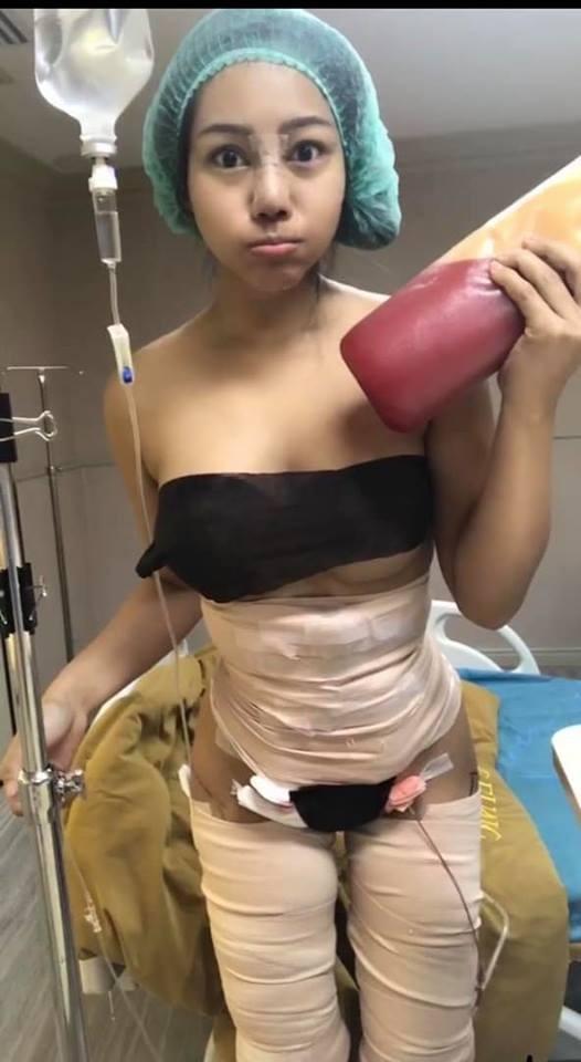 Cô gái chi tiền khủng đại phẫu thuật thẩm mỹ đau đớn để rồi sắc vóc khiến ai cũng kinh ngạc thảng thốt-4