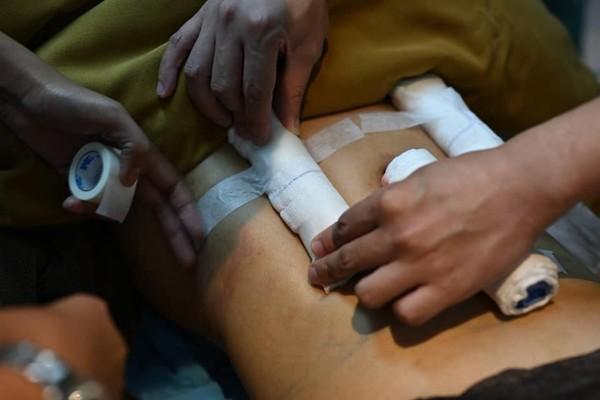 Cô gái chi tiền khủng đại phẫu thuật thẩm mỹ đau đớn để rồi sắc vóc khiến ai cũng kinh ngạc thảng thốt-6