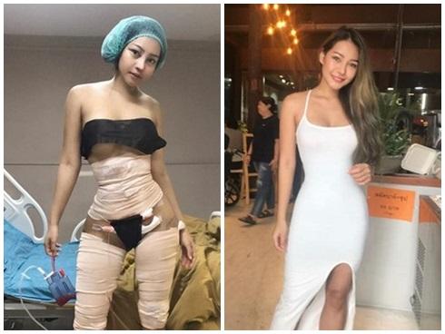 Cô gái chi tiền khủng đại phẫu thuật thẩm mỹ đau đớn để rồi sắc vóc khiến ai cũng kinh ngạc thảng thốt