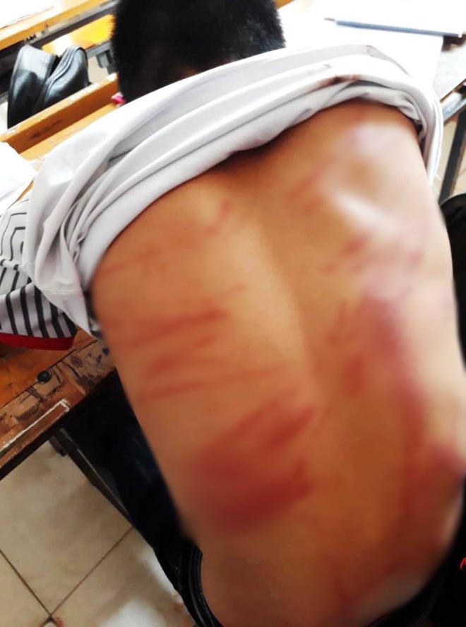 Vụ nam sinh lớp 8 bị bố đánh dã man phải nhập viện: Vợ cũ tố chồng từng đánh mình gãy tay và dọa giết-3