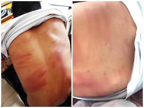 Người bố đánh con tứa máu vì con nghịch điện thoại-3