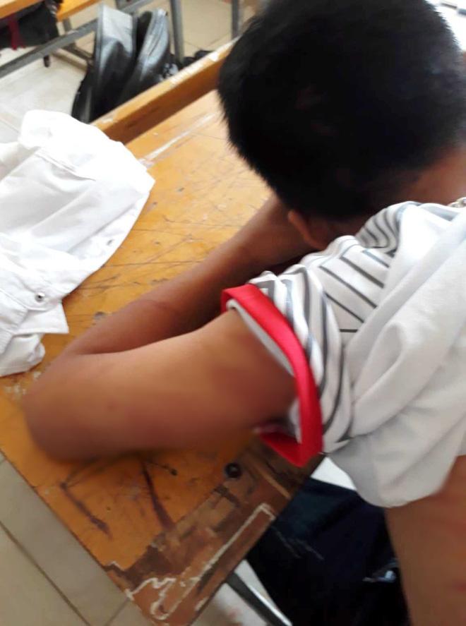 Vụ nam sinh lớp 8 bị bố đánh dã man phải nhập viện: Vợ cũ tố chồng từng đánh mình gãy tay và dọa giết-2