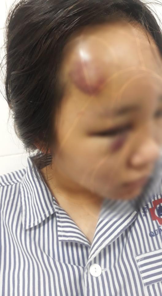 Vụ nữ sinh bị đánh hội đồng ở Quảng Ninh: Hẹn nhau ra giải quyết mâu thuẫn thì bị đánh úp-1