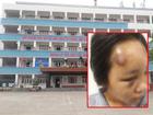Vụ nữ sinh bị đánh hội đồng ở Quảng Ninh: Hẹn nhau ra giải quyết mâu thuẫn thì bị đánh úp