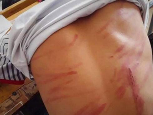 Cha dùng chổi đánh chết con gái 9 tuổi-2