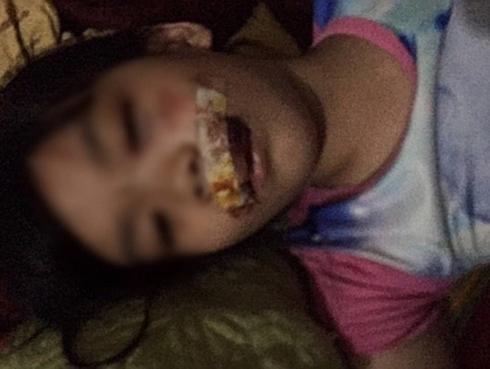 Chó 'điên' lao vào cắn 5 người rồi lăn đùng ra chết