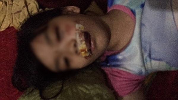 Chó điên lao vào cắn 5 người rồi lăn đùng ra chết-1