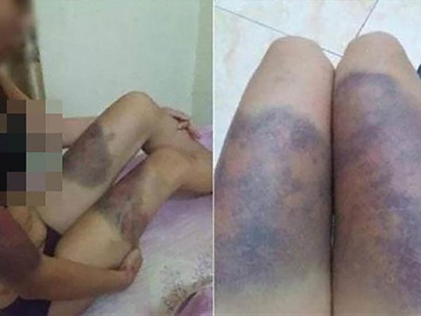 Cô gái mang thai 6 tháng bị bỏ đói, tra tấn khiến thai nhi tử vong: Em van xin họ cho về nuôi con nhỏ, nhưng không ai buông tha...-4