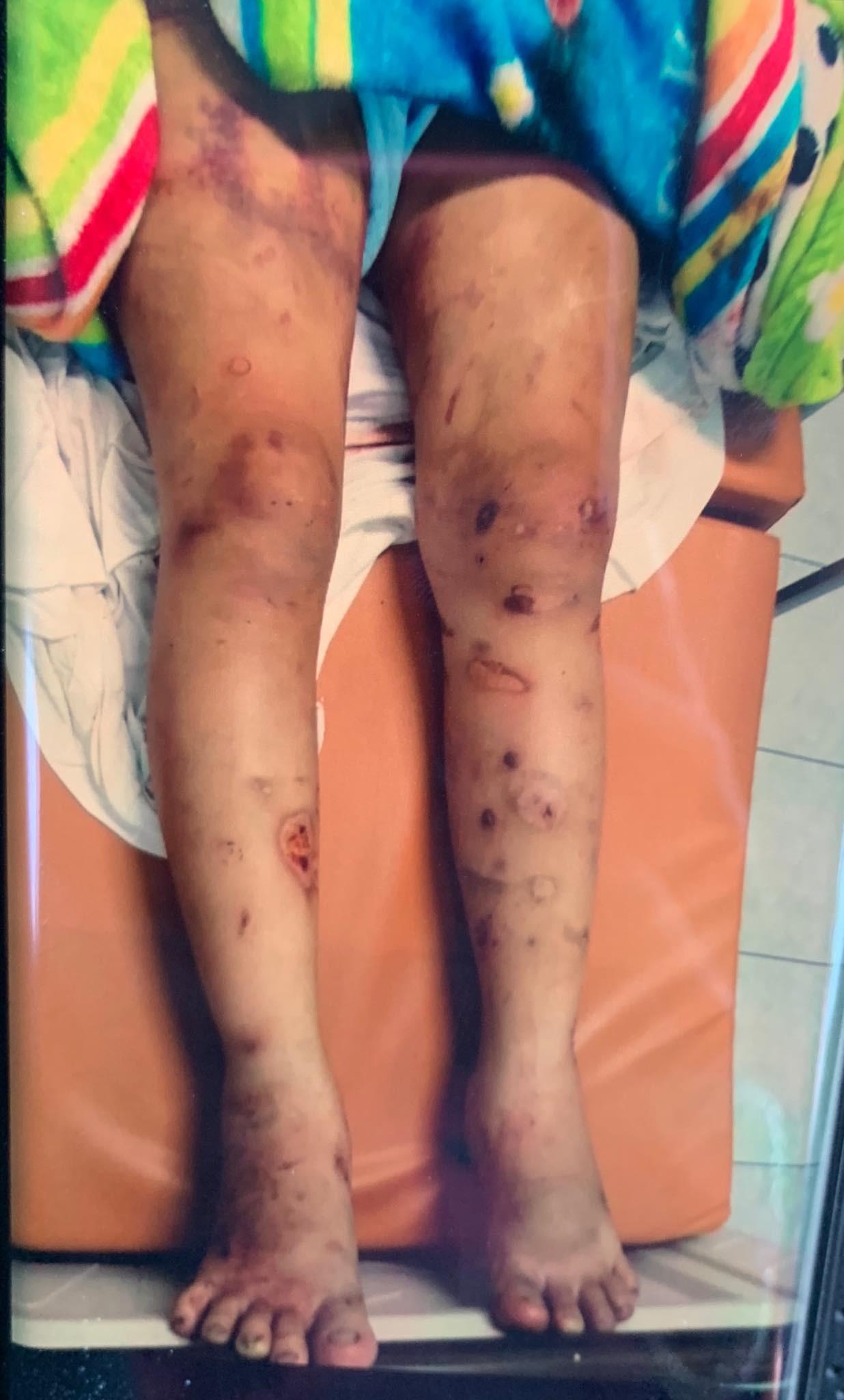 Cô gái mang thai 6 tháng bị bỏ đói, tra tấn khiến thai nhi tử vong: Em van xin họ cho về nuôi con nhỏ, nhưng không ai buông tha...-3