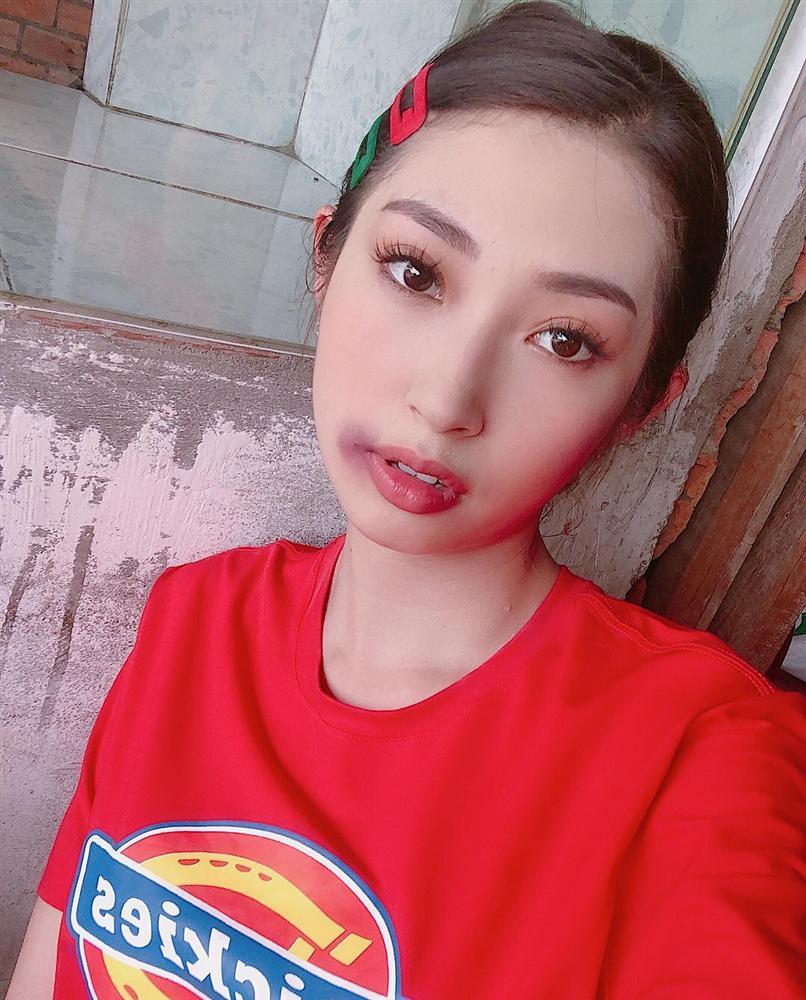 Khổng Tú Quỳnh bị đánh bầm dập mặt mày vẫn đam mê chụp ảnh-1