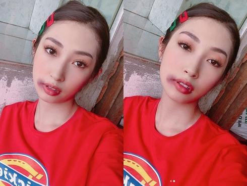 Khổng Tú Quỳnh bị đánh bầm dập mặt mày vẫn đam mê chụp ảnh