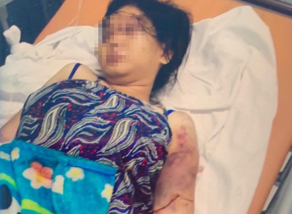 Cô gái bị đánh đến sẩy thai ở TP HCM: Cô ve chai kể phút thấy bé sơ sinh trong túi rác-2