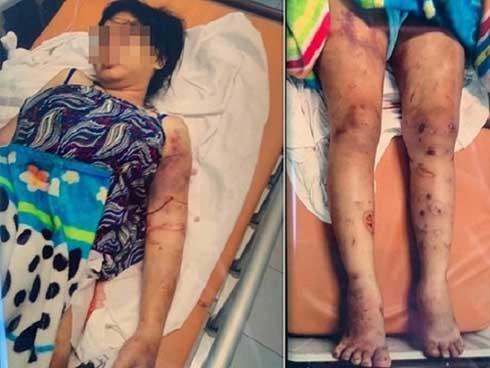 Vụ tra tấn như thời trung cổ khiến bà bầu sảy thai: Nạn nhân bị bắt hít ma túy, dùng ná bắn vào vùng kín-3