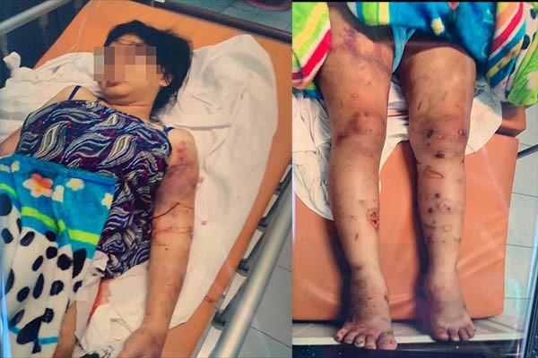 Vụ tra tấn như thời trung cổ khiến bà bầu sảy thai: Nạn nhân bị bắt hít ma túy, dùng ná bắn vào vùng kín-1