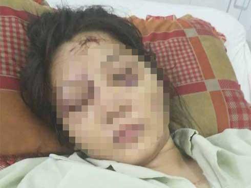 Vụ tra tấn như thời trung cổ khiến bà bầu sảy thai: Nạn nhân bị bắt hít ma túy, dùng ná bắn vào vùng kín