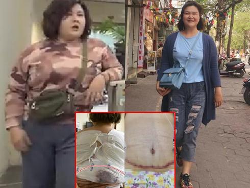 Hotgirl trăm ký Ngô Thủy Tiên - bà cô ghê gớm nhất Về Nhà Đi Con lần đầu chia sẻ cân nặng khổng lồ sau 2 lần hút mỡ đau tưởng chết-6