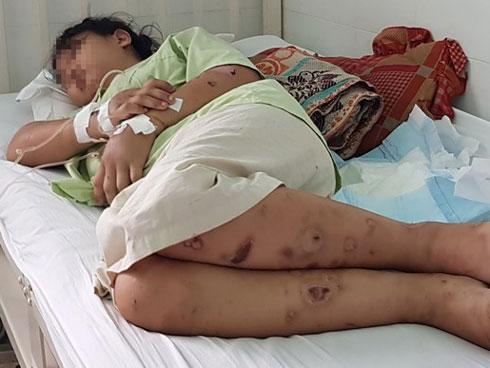 Bắt nghi phạm chủ mưu tra tấn cô gái 18 tuổi đến sẩy thai-3