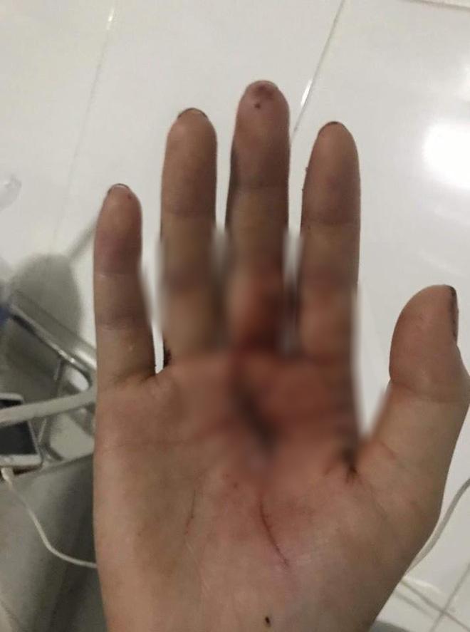 Vụ cô gái bị rạch mặt chằng chịt ở Bắc Ninh: Chúng ra tay quá tàn độc, mặt bị rạch thế coi như hết đời rồi-3