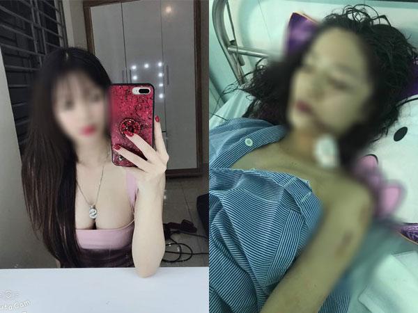 Vụ cô gái bị rạch mặt chằng chịt khâu 60 mũi: Nguyên nhân do tranh giành... cái tủ lạnh-3