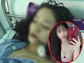 Vụ cô gái bị rạch mặt chằng chịt khâu 60 mũi: Nguyên nhân do tranh giành... cái tủ lạnh Vụ cô gái bị rạch mặt chằng chịt khâu 60 mũi: Nguyên nhân do tranh giành... cái tủ lạnh