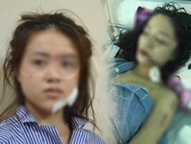Lời trần tình đẫm nước mắt của cô gái rạch mặt bạn cũ phải khâu 60 mũi: 'Sao mọi người chỉ bênh cô ấy mà mạt sát tôi?' Lời trần tình đẫm nước mắt của cô gái rạch mặt bạn cũ phải khâu 60 mũi: 'Sao mọi người chỉ bênh cô ấy mà mạt sát tôi?'